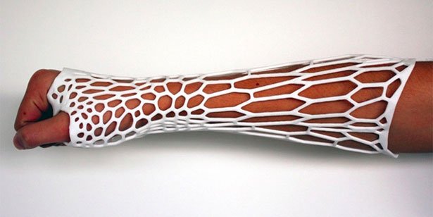 Casts & splints