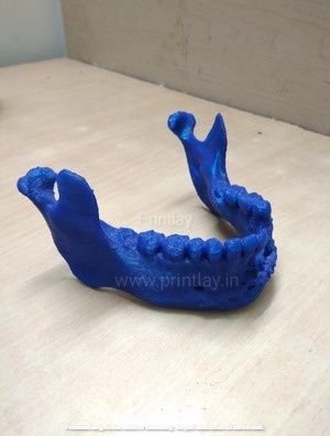 3D-Printing-Medical